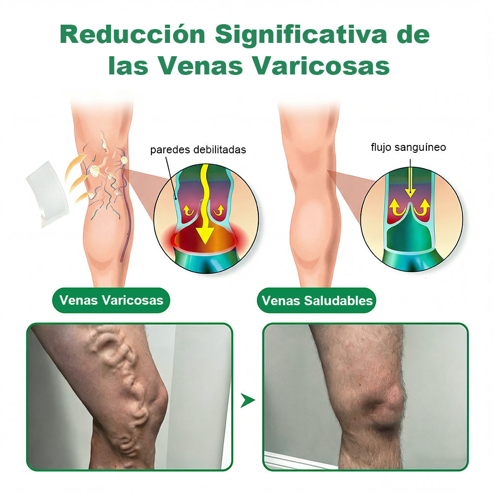 🎁 ¡Solo quedan 5 cajas! Disfruta ahora de un 50% de descuento adicional. Recupera tu forma y cuida tu salud. ¡Pierde peso ahora o no tendrás otra oportunidad hasta el próximo año!